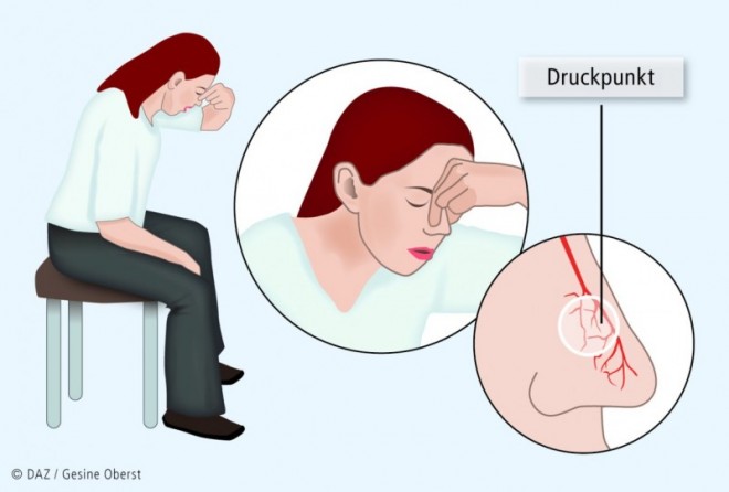 Nasenbluten – oft, aber nicht immer harmlos