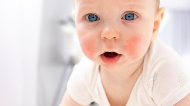 Kleine Patienten brauchen in der Apotheke spezifische Beratung.&nbsp;(Foto: Татьяна Немировская / AdobeStock)