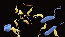 Um sich fortzupflanzen, befällt das Bakterium Bdellovibrio bacteriovorus (gelb) andere Bakterien (blau).