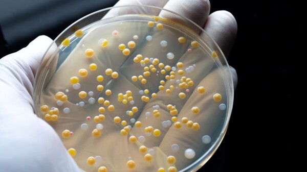 Was plant Europa im Kampf gegen antimikrobielle Resistenzen?