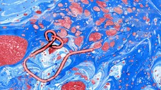 Die Wichtigkeit neuer Therapiestrategien gegen Ebola zeigt sich aktuell in der Epidemie in der D. R. Kongo, an der seit Juli 2018 über 2.200 Menschen gestorben sind. Kann nun ein neuer Impfstoff Hoffnung bringen? ( r / Foto: imago images / Panthermedia)