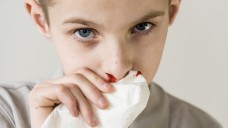 Bei Nasenbluten Kopf nach vorne beugen, Nasenflügel komprimieren und kein Blut schlucken. (Foto: Jan H. Andersen / stock.adobe.com)